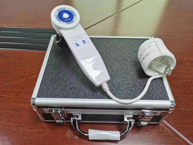 Cámara Digital de Iridología d - Qh Furnitures reseña y precio
